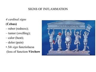 SIGNS OF INFLAMMATION
4 cardinal signs
(Celsus)
– rubor (redness);
– tumor (swelling);
– calor (heat);
– dolor (pain)
• 5th sign functiolaesa
(loss of function-Virchow
 