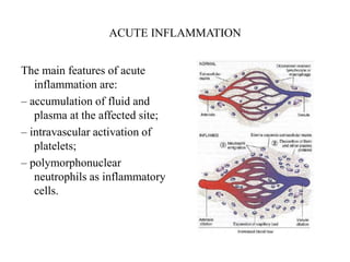 ACUTE INFLAMMATION
The main features of acute
inflammation are:
– accumulation of fluid and
plasma at the affected site;
– intravascular activation of
platelets;
– polymorphonuclear
neutrophils as inflammatory
cells.
 