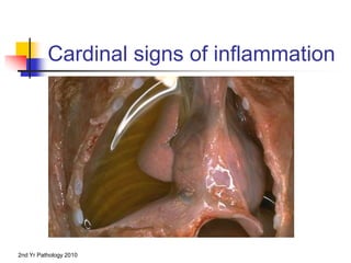 2nd Yr Pathology 2010
Cardinal signs of inflammation
 