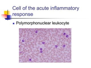 Cell of the acute inflammatory
response
 Polymorphonuclear leukocyte
 