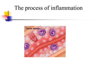 The process of inflammation
 