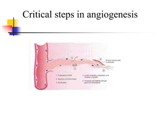 Critical steps in angiogenesis
 