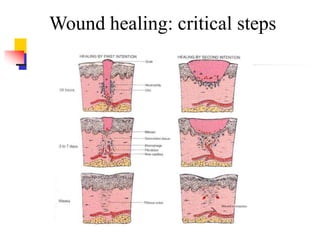 Wound healing: critical steps
 