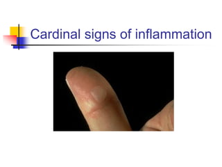 Cardinal signs of inflammation
 