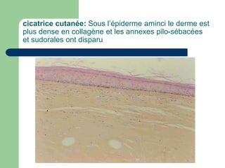 cicatrice cutanée: Sous l’épiderme aminci le derme est
plus dense en collagène et les annexes pilo-sébacées
et sudorales ont disparu
 