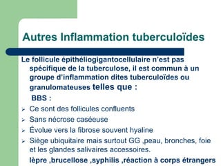 Autres Inflammation tuberculoïdes
Le follicule épithéliogigantocellulaire n’est pas
spécifique de la tuberculose, il est commun à un
groupe d’inflammation dites tuberculoïdes ou
granulomateuses telles que :
BBS :
 Ce sont des follicules confluents
 Sans nécrose caséeuse
 Évolue vers la fibrose souvent hyaline
 Siège ubiquitaire mais surtout GG ,peau, bronches, foie
et les glandes salivaires accessoires.
lèpre ,brucellose ,syphilis ,réaction à corps étrangers
 