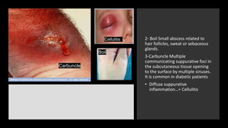 Inflammation and Repair | PPTX
