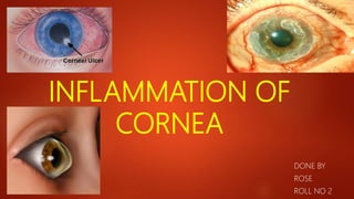 INFLAMMATION OF
CORNEA
DONE BY
ROSE
ROLL NO 2
 