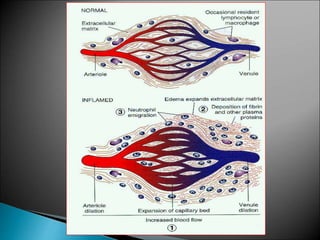 VASCULAR EVENTS OF INFLAMMATION - PATHOLOGY | PPT