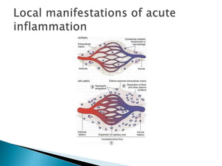 VASCULAR EVENTS OF INFLAMMATION - PATHOLOGY | PPT
