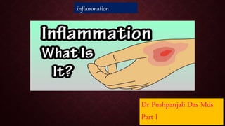 Dr Pushpanjali Das Mds
Part I
inflammation
 