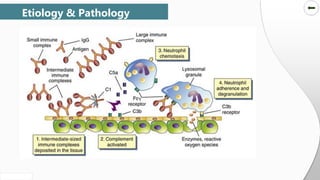 SLIDESMANIA.COM
SLIDESMANIA.COM
Etiology & Pathology
 