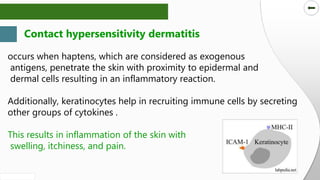 SLIDESMANIA.COM
SLIDESMANIA.COM
Contact hypersensitivity dermatitis
occurs when haptens, which are considered as exogenous
antigens, penetrate the skin with proximity to epidermal and
dermal cells resulting in an inflammatory reaction.
Additionally, keratinocytes help in recruiting immune cells by secreting
other groups of cytokines .
This results in inflammation of the skin with
swelling, itchiness, and pain.
 