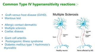 • Graft-versus-host disease (GVHD).
• Mantoux test
• Allergic contact dermatitis
• Multiple sclerosis
• Coeliac disease.
• Giant-cell arteritis
• Postorgasmic illness syndrome
• Diabetes mellitus type 1 Hashimoto's
thyroiditis
Common Type IV hypersensitivity reactions :-
 
