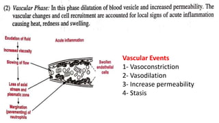 Vascular Events
1- Vasoconstriction
2- Vasodilation
3- Increase permeability
4- Stasis
 