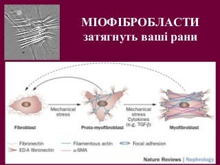 МІОФІБРОБЛАСТИ
затягнуть ваші рани
 