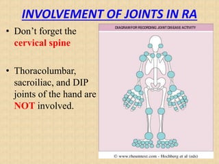 INVOLVEMENT OF JOINTS IN RA
• Don’t forget the
cervical spine
• Thoracolumbar,
sacroiliac, and DIP
joints of the hand are
NOT involved.
 