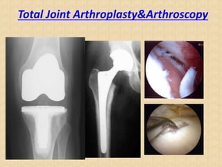 Total Joint Arthroplasty&Arthroscopy
 