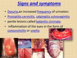 Signs and symptoms
• Dysuria,an increased frequency of urination.
• Prostatitis,cervicitis, salpingitis,vulvovaginitis
• penile lesions called balanitis circinata.
• inflammation of the eyes in the form of
conjunctivitis or uveitis
 