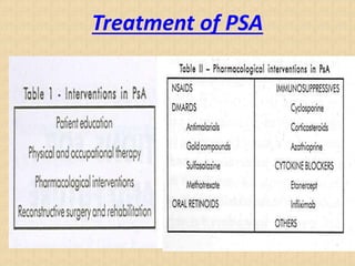 Treatment of PSA
 
