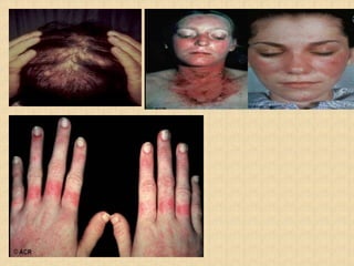 inflammatoryarthritis-170820154705 (1).pdf