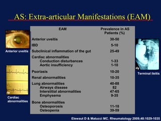 AS:AS: Extra-articular Manifestations (EAM)Extra-articular Manifestations (EAM)
EAM Prevalence in AS
Patients (%)
Anterior uveitis 30-50
IBD 5-10
Subclinical inflammation of the gut 25-49
Cardiac abnormalities
Conduction disturbances
Aortic insufficiency
1-33
1-10
Psoriasis 10-20
Renal abnormalities 10-35
Lung abnormalities
Airways disease
Interstitial abnormalities
Emphysema
40-88
82
47-65
9-35
Bone abnormalities
Osteoporosis
Osteopenia
11-18
39-59
Elewaut D & Matucci MC. Rheumatology 2009;48:1029-1035
Terminal ileitis
Anterior uveitis
Cardiac
abnormalities
 