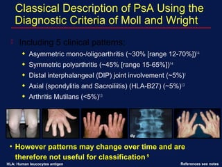 Classical Description of PsA Using the
Diagnostic Criteria of Moll and Wright
 Including 5 clinical patterns:
x Asymmetric mono-/oligoarthritis (~30% [range 12-70%])1-4
x Symmetric polyarthritis (~45% [range 15-65%])1-4
x Distal interphalangeal (DIP) joint involvement (~5%)1
x Axial (spondylitis and Sacroiliitis) (HLA-B27) (~5%)1,3
x Arthritis Mutilans (<5%)1,3
References see notes
• However patterns may change over time and are
therefore not useful for classification 5
HLA: Human leucocytes antigen
 