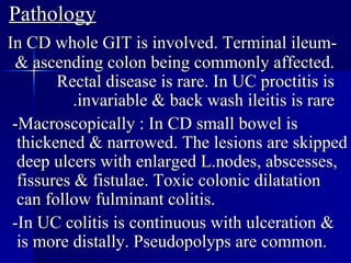 Pathology -In CD whole GIT is involved. Terminal ileum & ascending colon being commonly affected. Rectal disease is rare. In UC proctitis is invariable & back wash ileitis is rare. -Macroscopically : In CD small bowel is thickened & narrowed. The lesions are skipped deep ulcers with enlarged L.nodes, abscesses, fissures & fistulae. Toxic colonic dilatation can follow fulminant colitis. -In UC colitis is continuous with ulceration & is more distally. Pseudopolyps are common. 