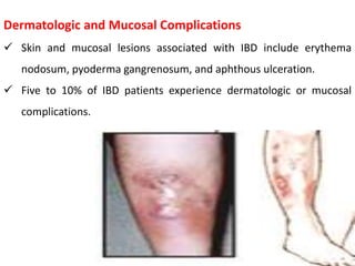 Inflammatory bowel disease | PPTX