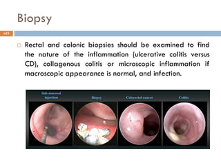 Biopsy
15
 Rectal and colonic biopsies should be examined to find
the nature of the inflammation (ulcerative colitis versus
CD), collagenous colitis or microscopic inflammation if
macroscopic appearance is normal, and infection.
 