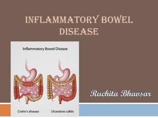 INFLAMMATORY BOWEL
DISEASE
Ruchita Bhavsar
 