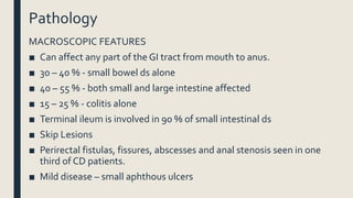Pathology
MACROSCOPIC FEATURES
■ Can affect any part of the GI tract from mouth to anus.
■ 30 – 40 % - small bowel ds alone
■ 40 – 55 % - both small and large intestine affected
■ 15 – 25 % - colitis alone
■ Terminal ileum is involved in 90 % of small intestinal ds
■ Skip Lesions
■ Perirectal fistulas, fissures, abscesses and anal stenosis seen in one
third of CD patients.
■ Mild disease – small aphthous ulcers
 