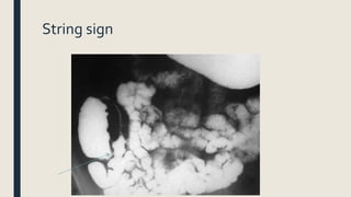 String sign
 