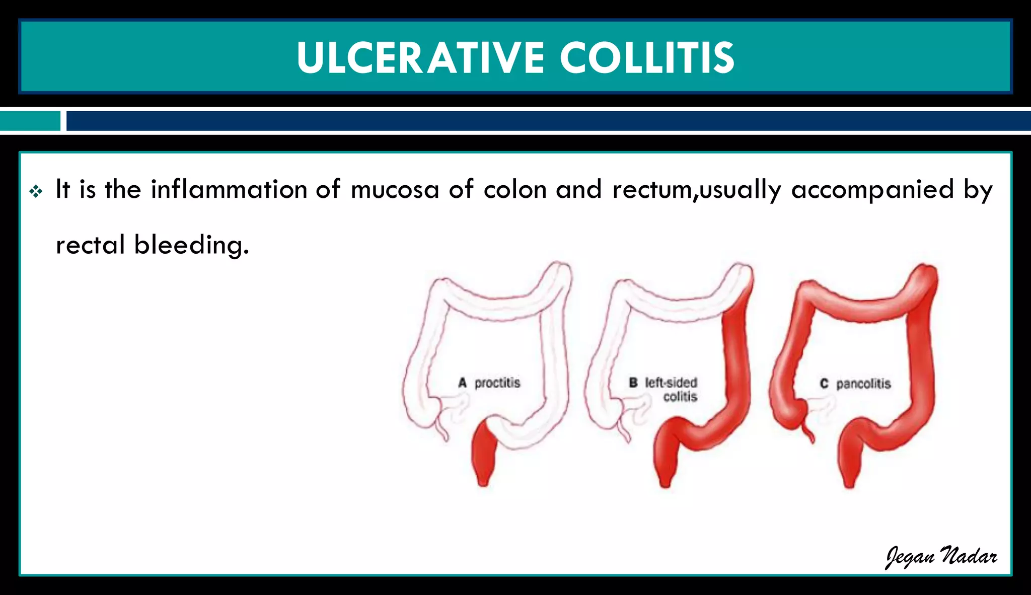 Pathophysiology of Inflammatory bowel disease | PDF