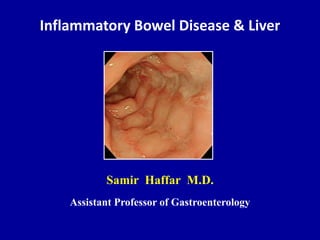 Inflammatory Bowel Disease & Liver
Samir Haffar M.D.
Assistant Professor of Gastroenterology
 