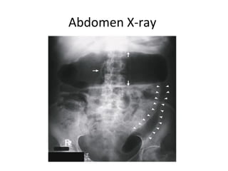 Abdomen X-ray
 