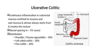 Ulcerative Colitis:
Continuous inflammation in colorectal
mucosa confined to mucosa and
sub-mucosa & almost always starts from
& involve the rectum
(Rectal sparing in ~ 5% cases)
Distribution
• Proctitis / Procto-sigmoiditis – 50%
• Left sided colitis – 30%
• Pan-colitis – 20%
 