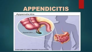 APPENDICITIS
 