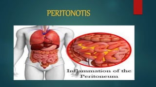 PERITONOTIS
 