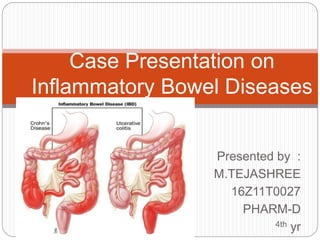 Presented by :
M.TEJASHREE
16Z11T0027
PHARM-D
4th yr
Case Presentation on
Inflammatory Bowel Diseases
 