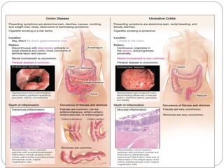 Inflammatory bowel diseases 