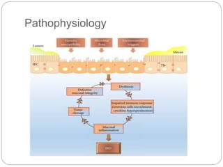 Inflammatory bowel diseases 