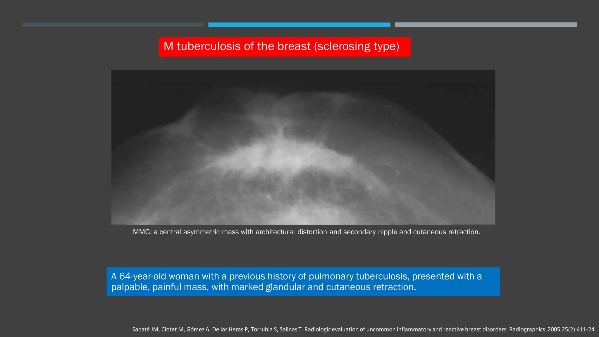 Inflammatory breast disease handout pdf blood disorders diseases