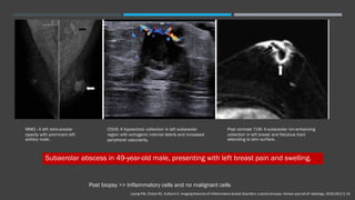 inflammatory breast disease (Handout).pdf