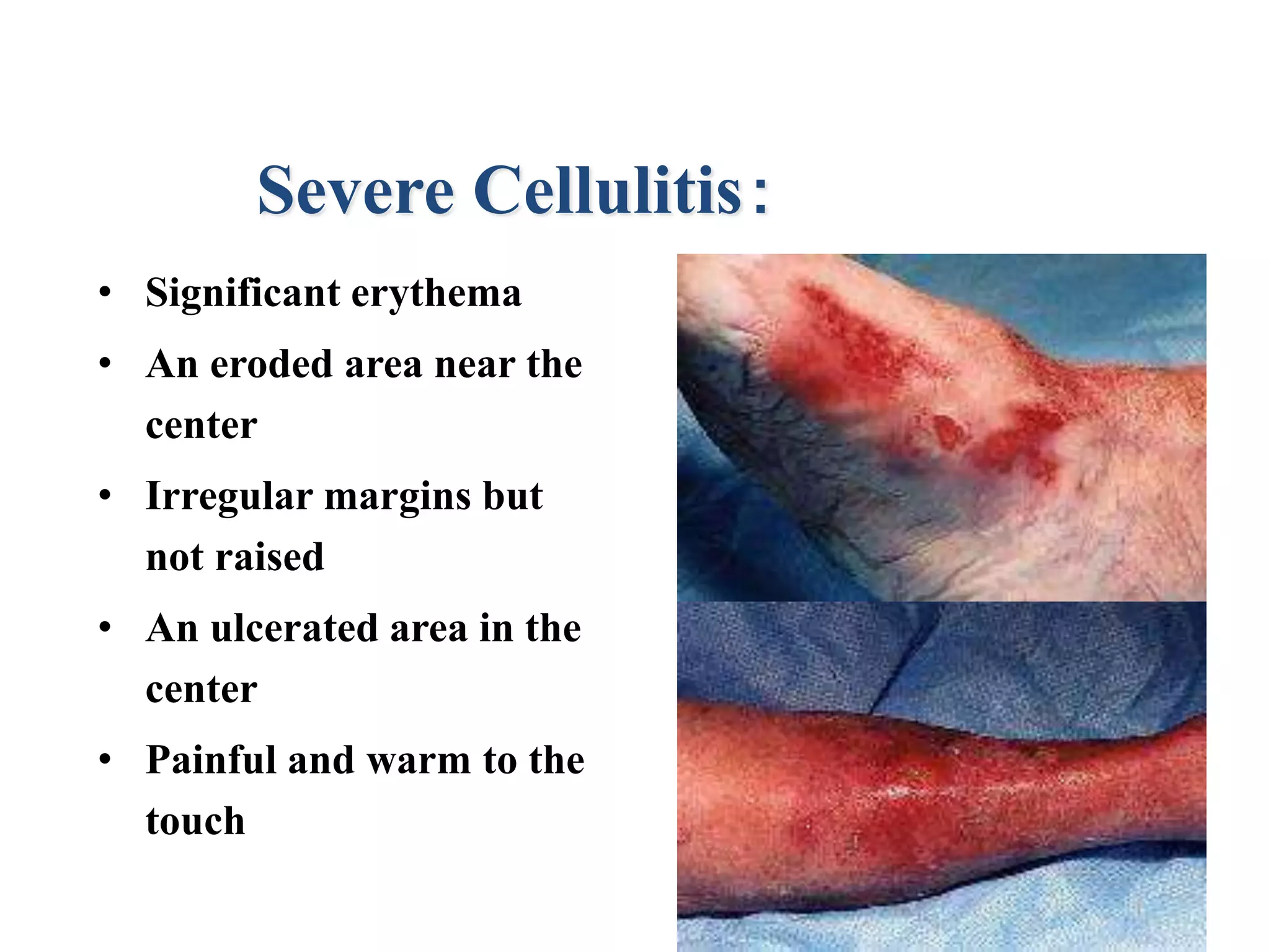 Inflammatory conditions of skin | PPTX