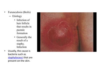 Inflammatory conditions of skin | PPTX