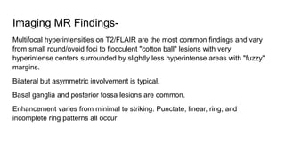 Inflammatory Demyelinating disorders.pptx
