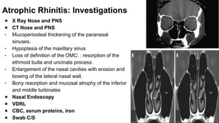 INFLAMMATORY DISEASES OF NOSE (INCLUDING Atrophic rhinitis, Allergic ...