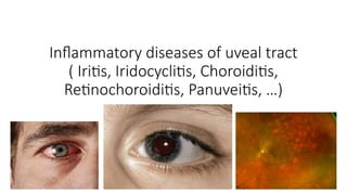 Comprehensive Overview of Uveitis: Classification, Diagnosis, and ...