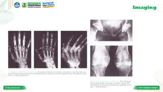 Inflammatory Disorders of Bone and Joints - RI 2.pptx